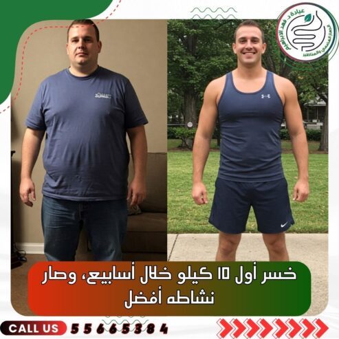 بالون المعدةمع د.فهد الإبراهيم